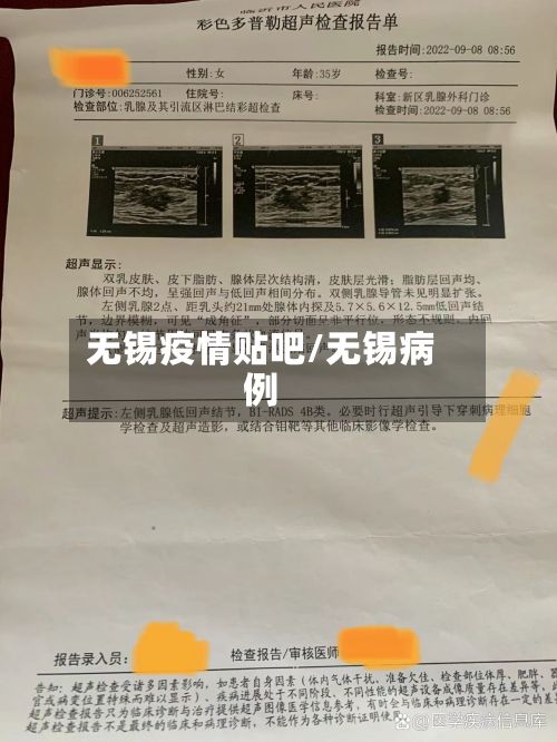 无锡疫情贴吧/无锡病例-第1张图片