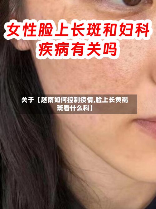 关于【越南如何控制疫情,脸上长黄褐斑看什么科】-第1张图片