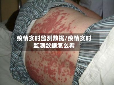 疫情实时监测数据/疫情实时监测数据怎么看-第1张图片